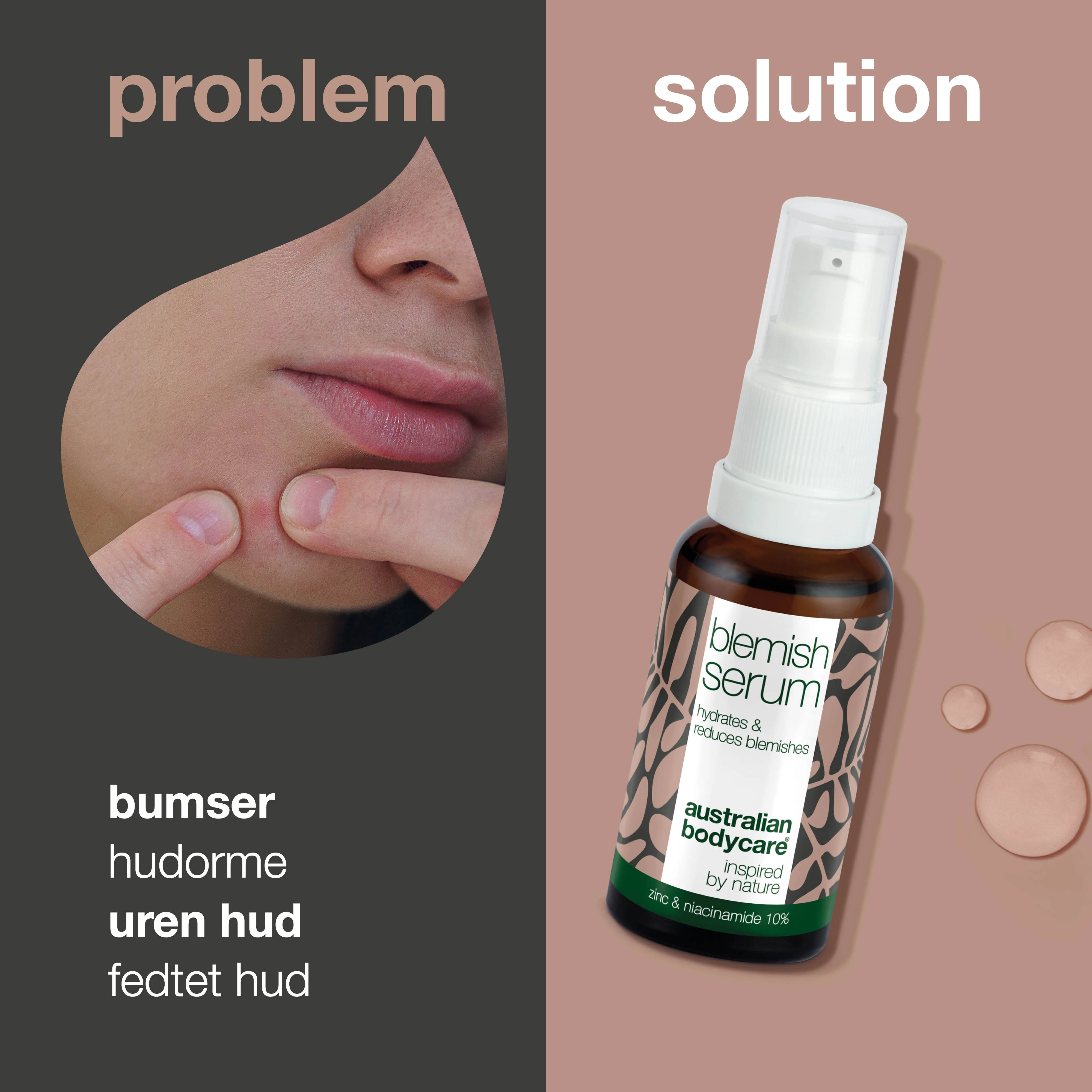 Niacinamide Serum – Mindsker rødme, urenheder og fedtet hud — Niacinamide Serum reducerer rødme, fedtet hud og urenheder. Indeholder 10% niacinamid, zink og hyaluronsyre for en sund og jævn hud. - Image 2