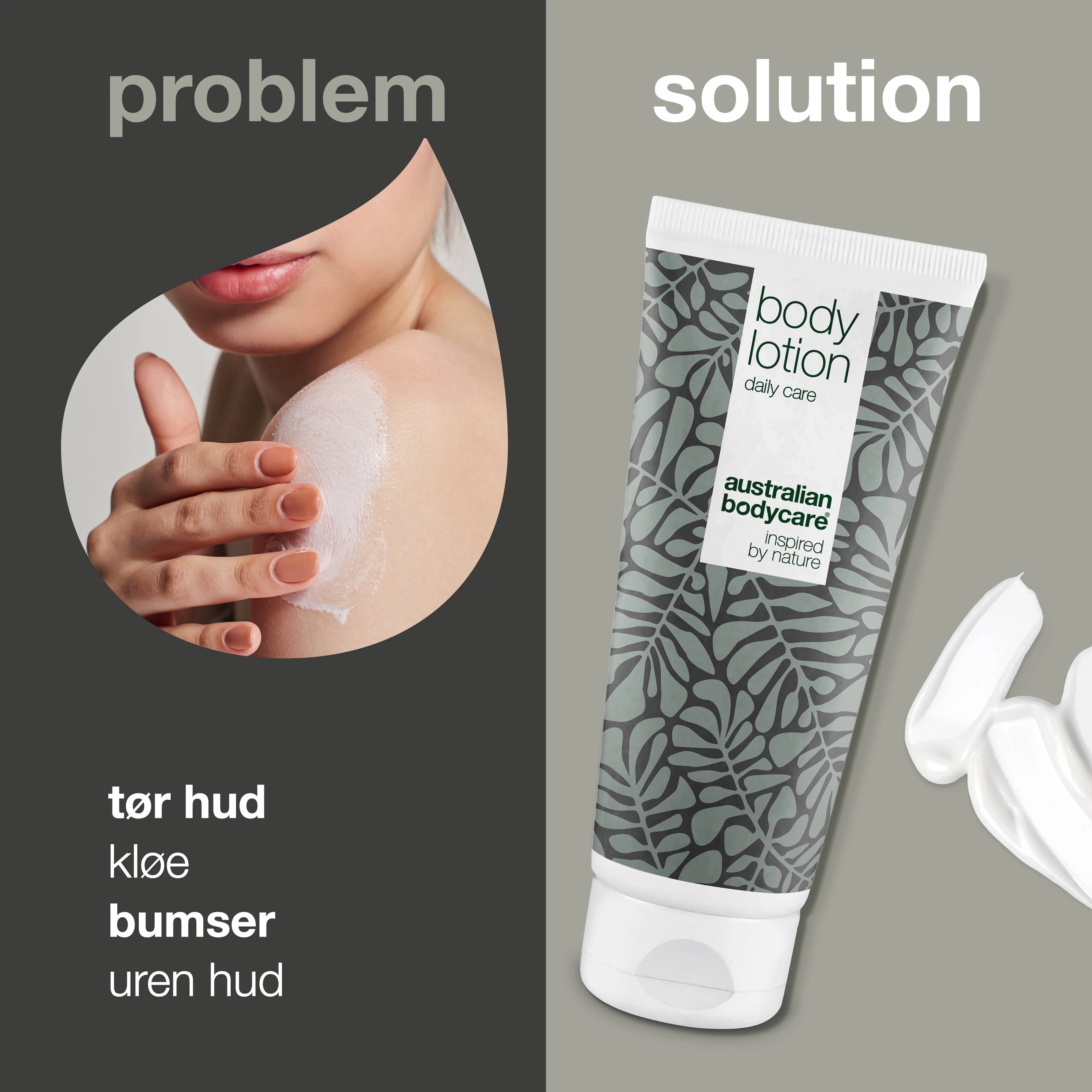 Body Lotion til tør hud og mod bumser — Fugtgivende creme til tør og uren hud på kroppen - Image 2
