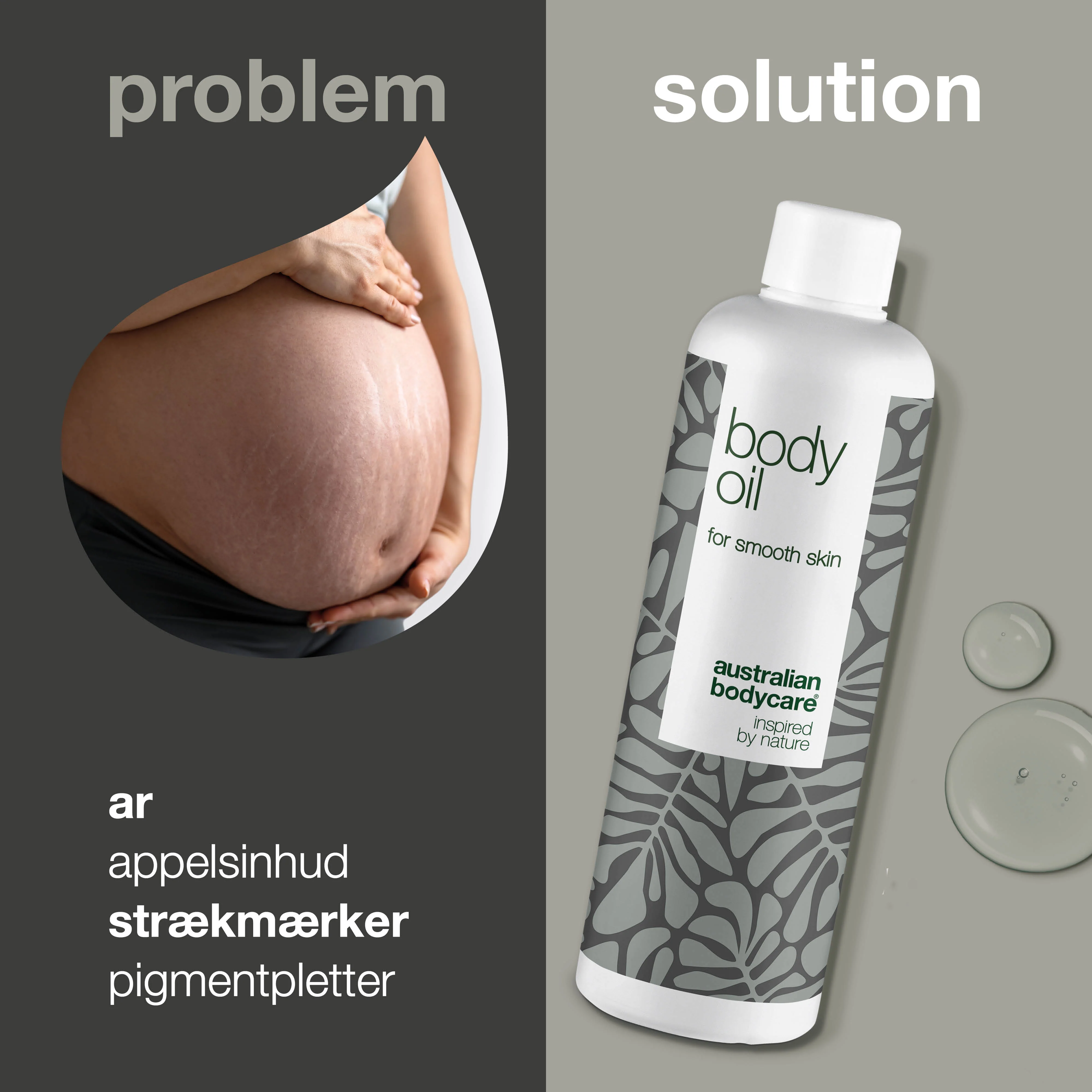 Body Oil – Reducerer strækmærker, ar og pigmentpletter — Body Oil reducerer strækmærker, ar og pigmentpletter. Med mandelolie, squalane og vitamin E efterlades huden blød, smidig og velplejet. - Image 2