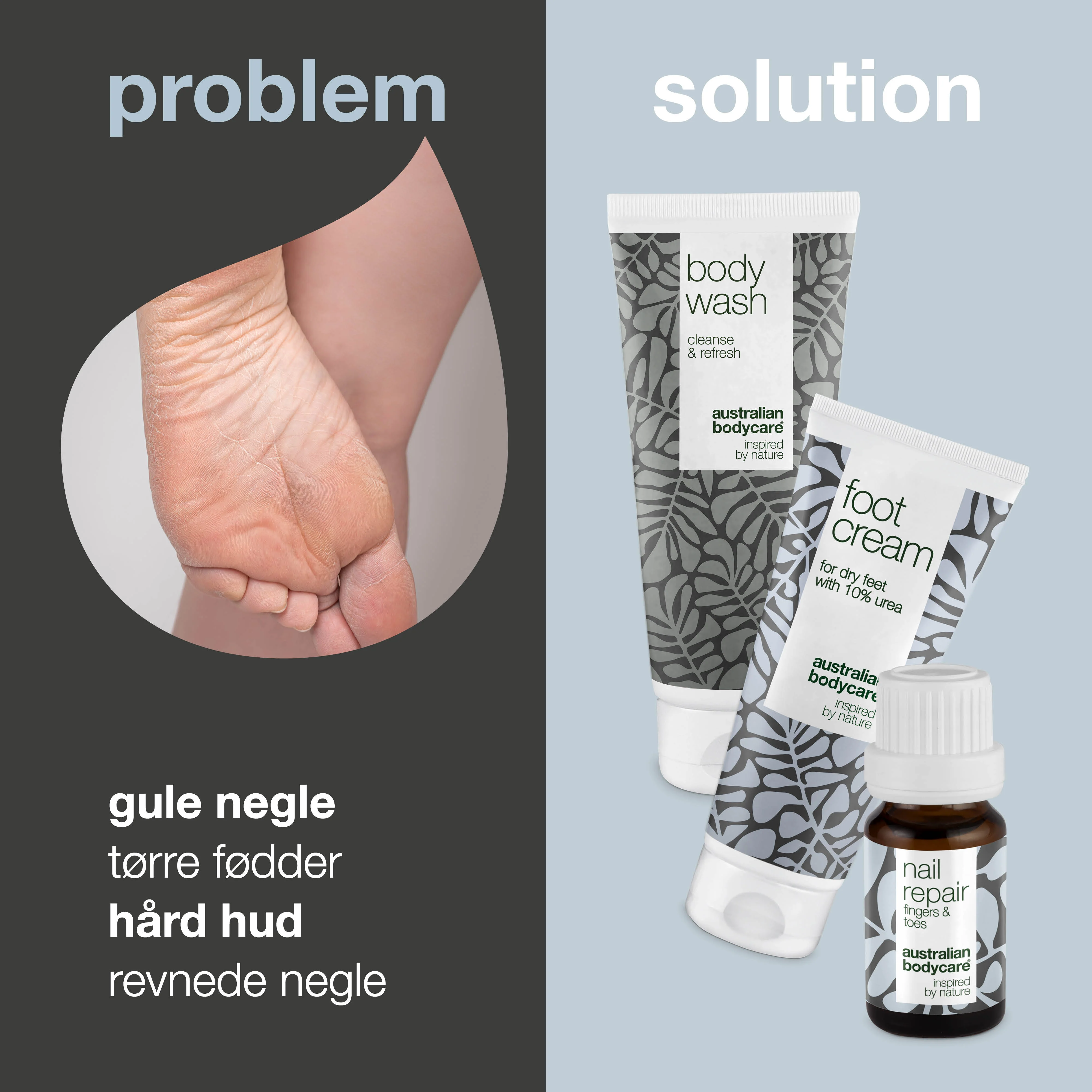 Fodplejepakke — 3 produkter til daglig pleje af tørre fødder og gule negle - Image 2