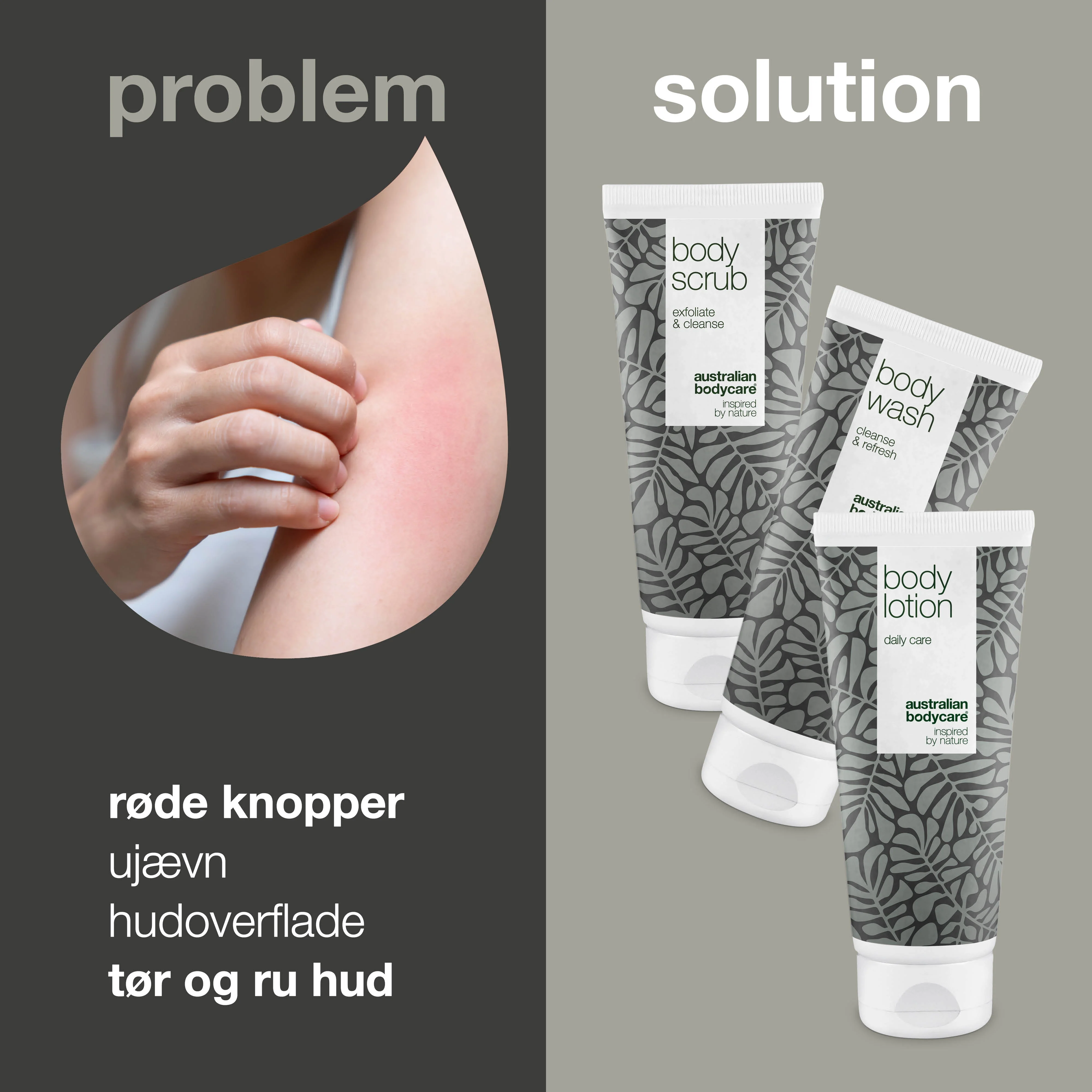 3-pak til keratosis pilaris — minimerer små røde knopper på kroppen fra keratosis pilaris - Image 2