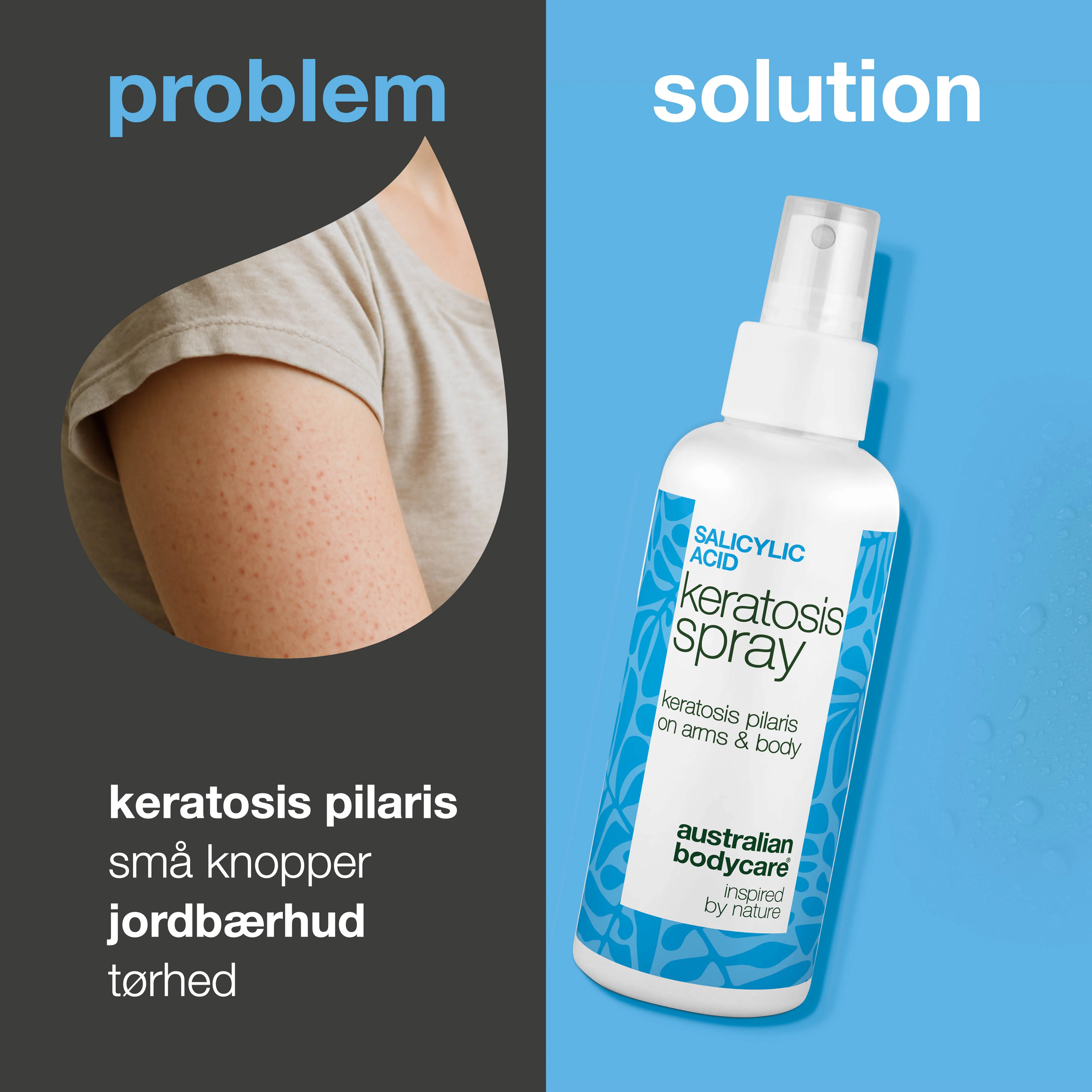 Keratosis Pilaris Spray mod knopper og ru hud på kroppen — Keratosis pilaris spray reducerer knopper og ujævn hud. Bruges dagligt – indeholder effektiv salicylsyre. - Image 2