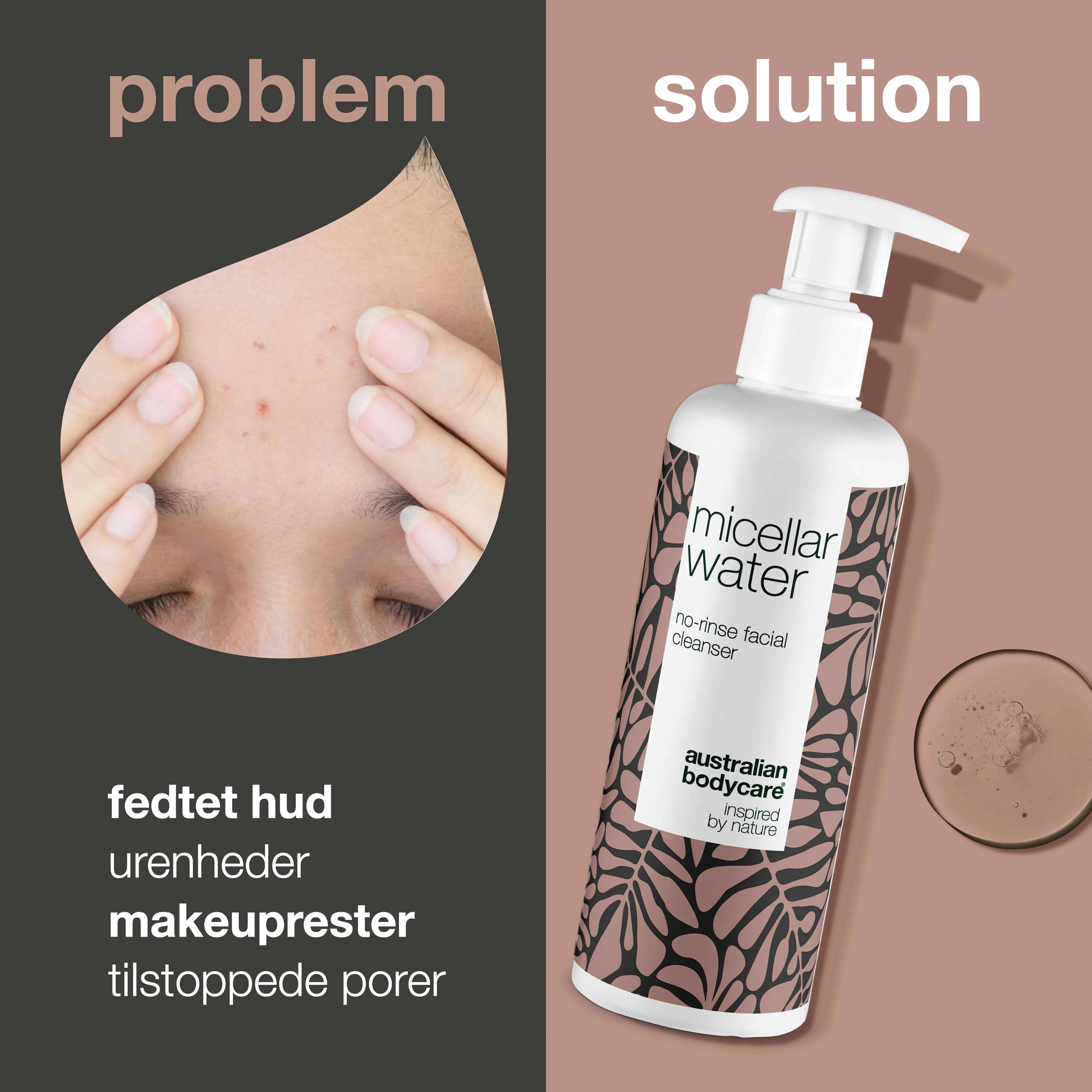 Micellar Water – Effektiv rens til uren og fedtet hud — Micellar Water fjerner makeup, snavs og overskydende olie. Perfekt til uren hud og daglig ansigtsrens. - Image 2