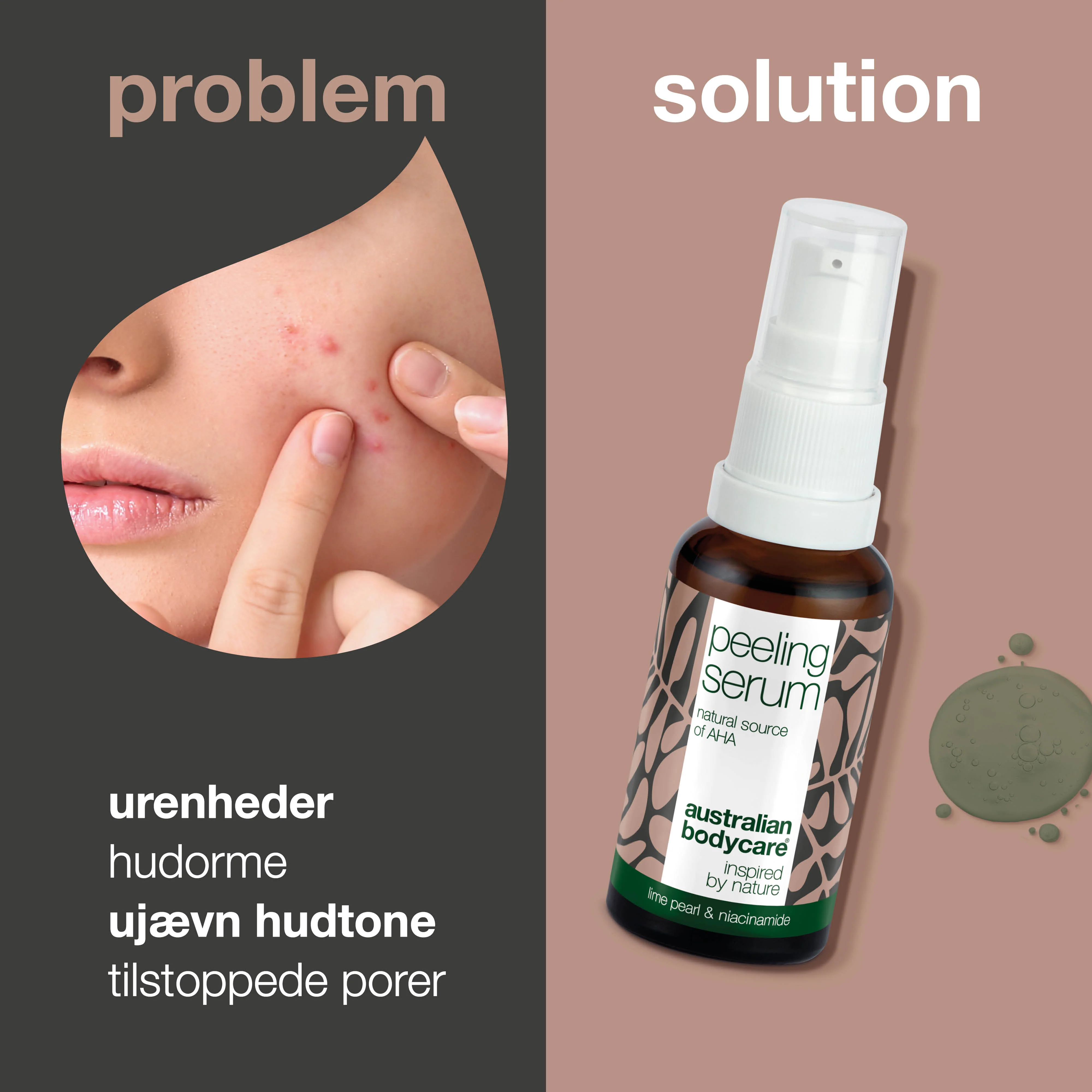 AHA Peeling Serum – Eksfoliering for glattere og friskere hud — AHA Peeling Serum fjerner døde hudceller, udjævner hudens tekstur og giver en sund glød. Med Lime Pearl, Niacinamid og Allantoin. - Image 2
