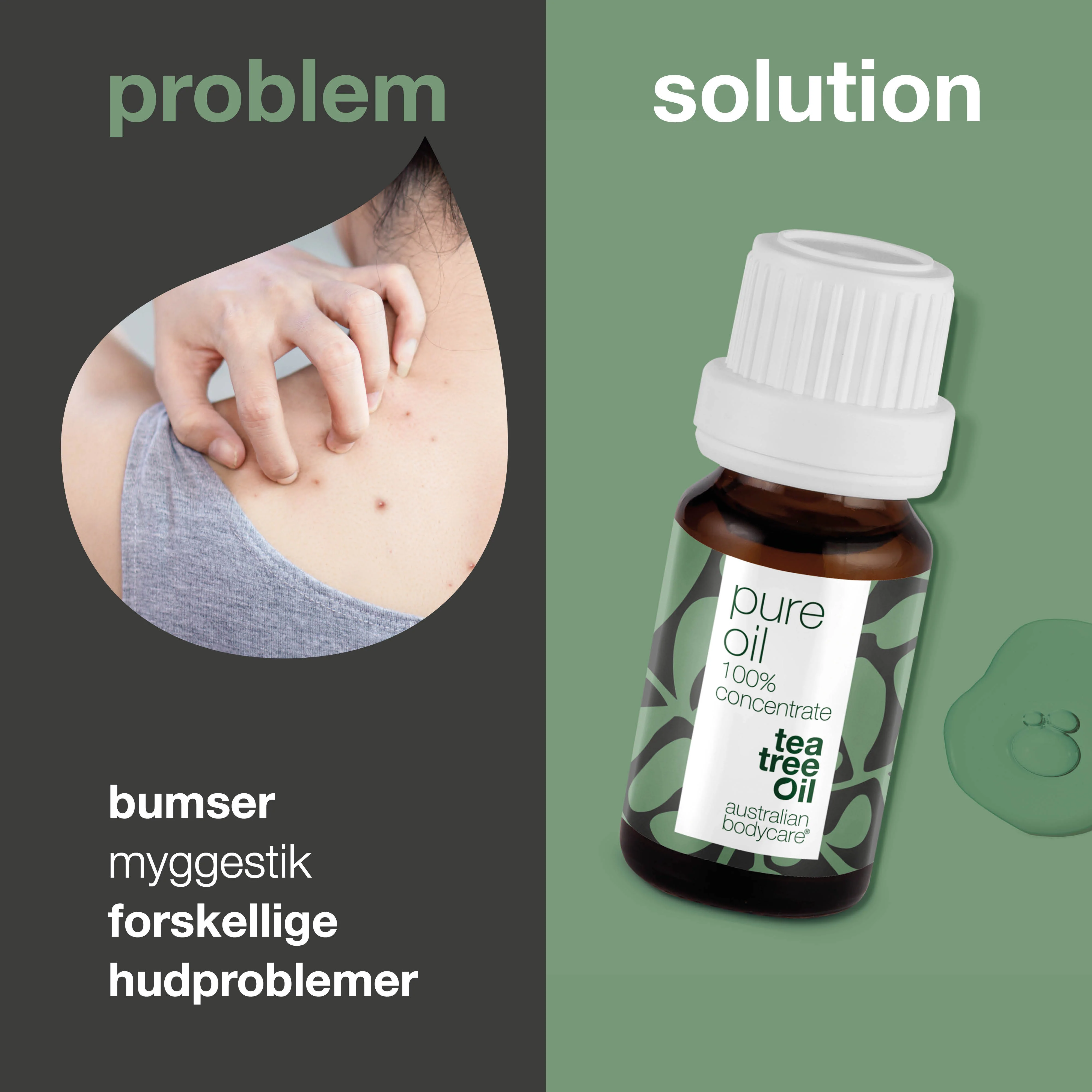 Koncentreret Tea Tree Oil til hudproblemer — 100% naturlig og ufortyndet Tea Tree Oil fra Australien - Image 2