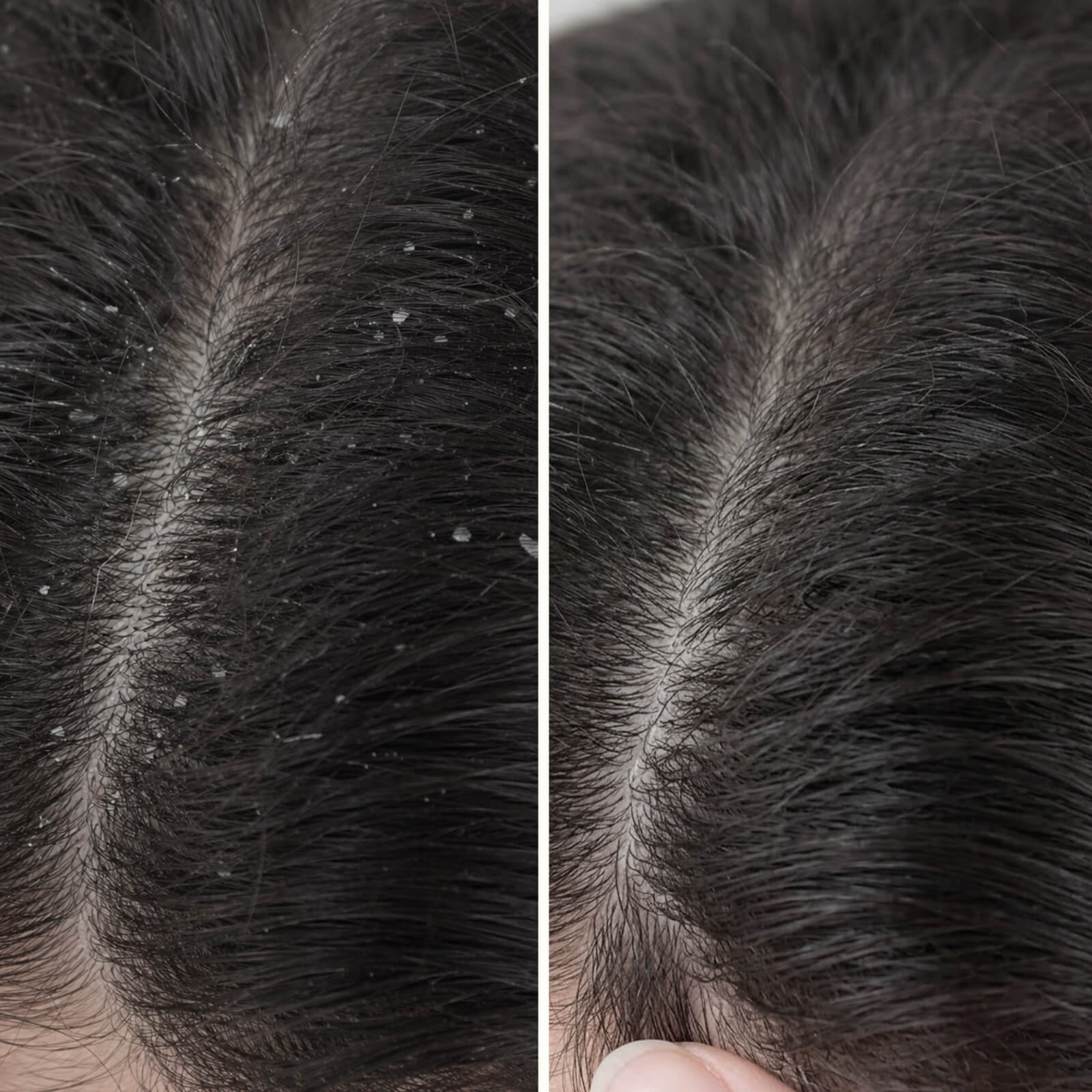 Balsam med Salicylsyre mod skæl og kløende hovedbund — Fugtgivende conditioner til tør hovedbund/hår og knækket hår. Giver blødt hår og lindring med effektiv Salicylsyre. - Image 6