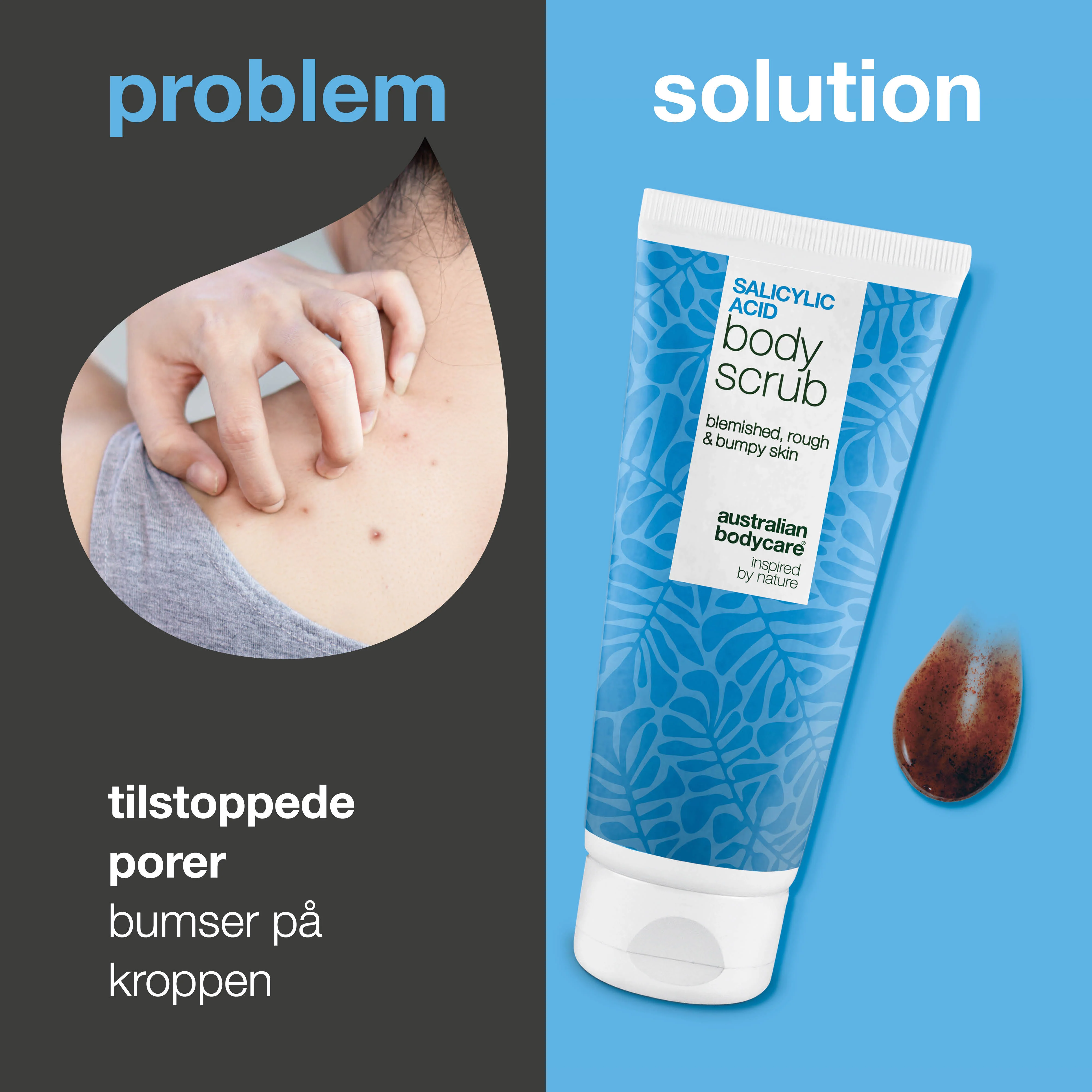 Body Scrub med salicylsyre til uren hud på kroppen – giver glattere hud — Body Scrub med salicylsyre fjerner døde hudceller, bumser og tilstoppede porer. Indeholder salicylsyre, glykolsyre & glycerin - Image 2