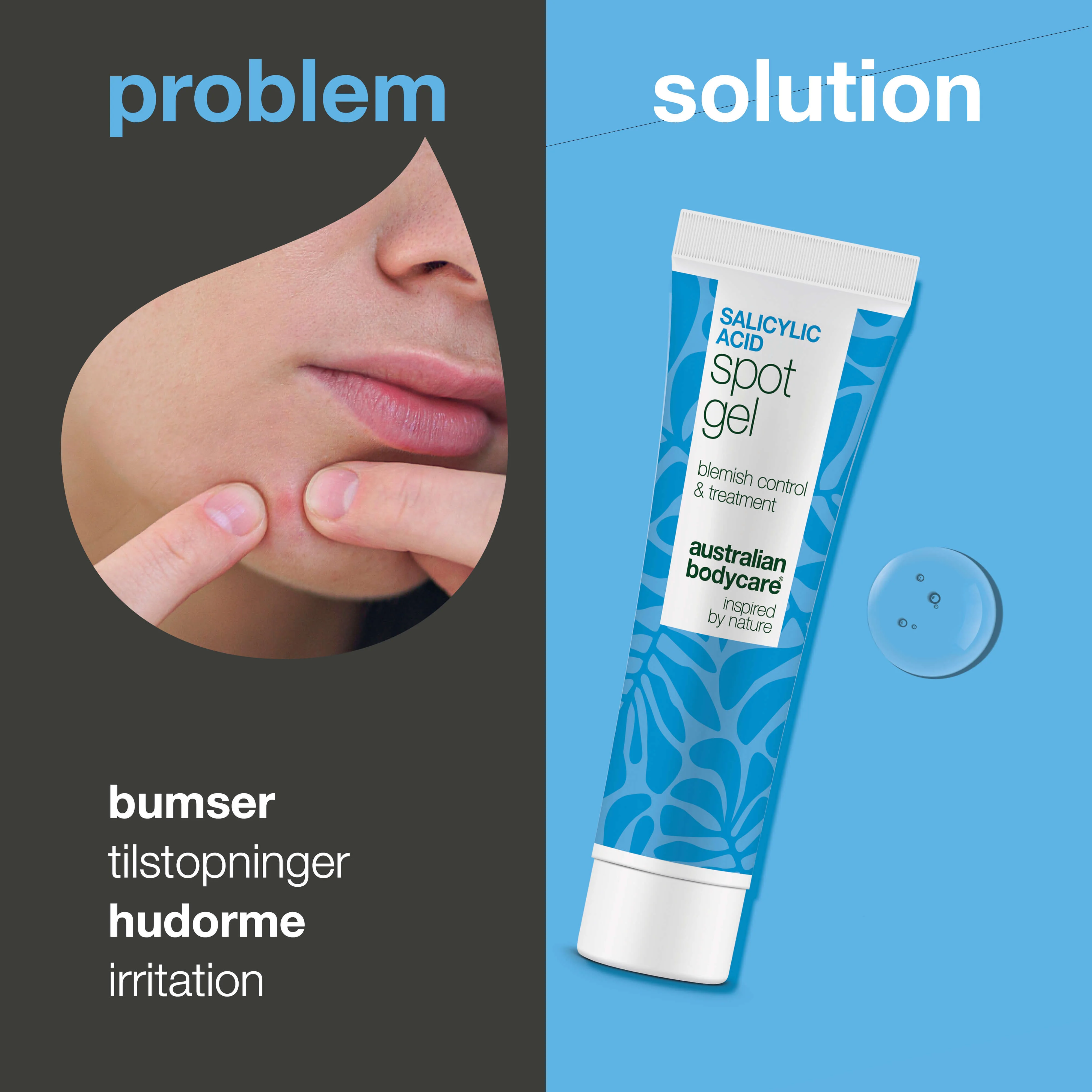 Salicylsyre Spot Gel mod bumser, hudorme og rødme — Salicylsyre Spot Gel til uren hud. Reducerer rødme og tilstopninger med effektiv salicylsyre for en klarere hud. - Image 2