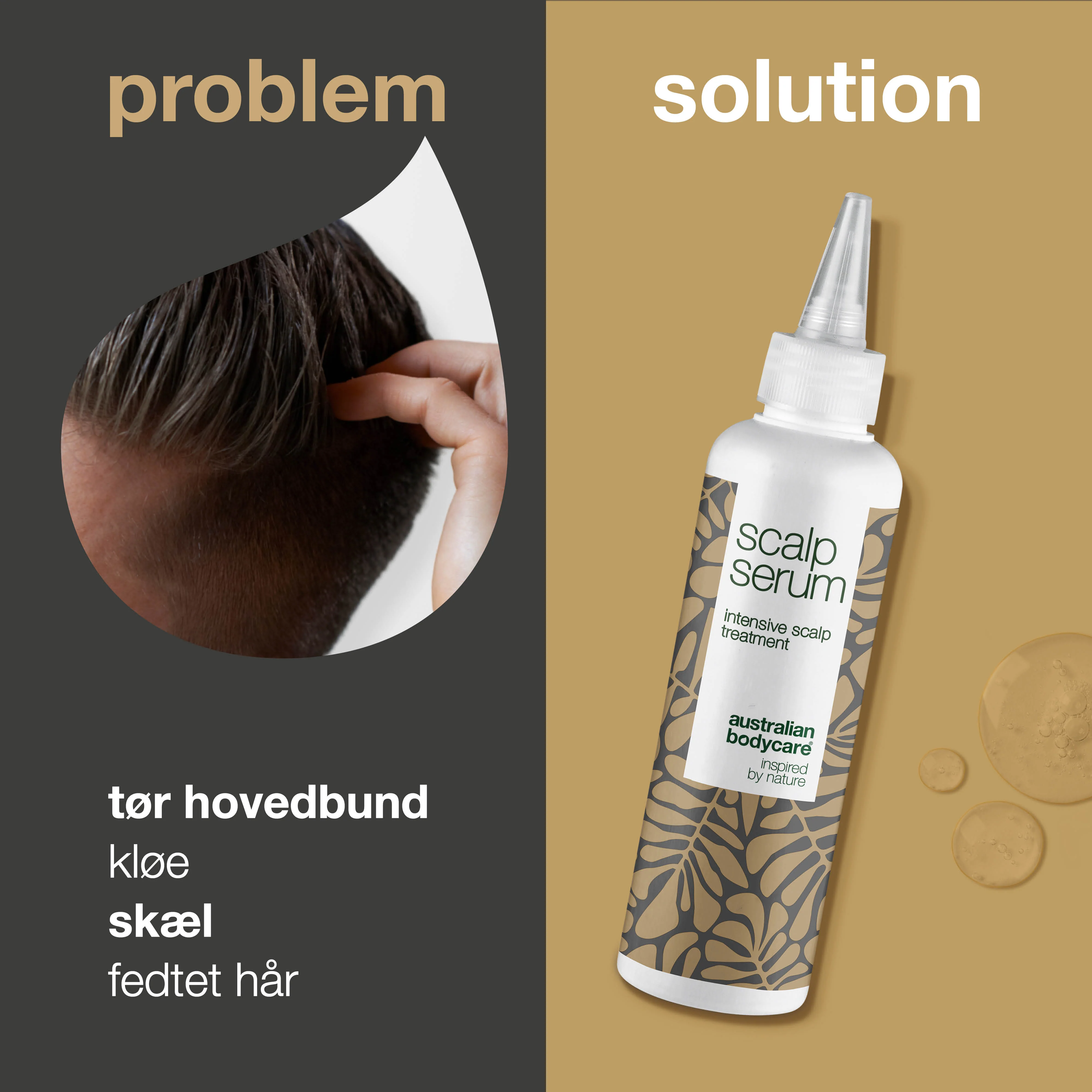 Hovedbundskur mod skæl og tør hovedbund — Serum til kløende hovedbund, fedtet hår og irritation - Image 2