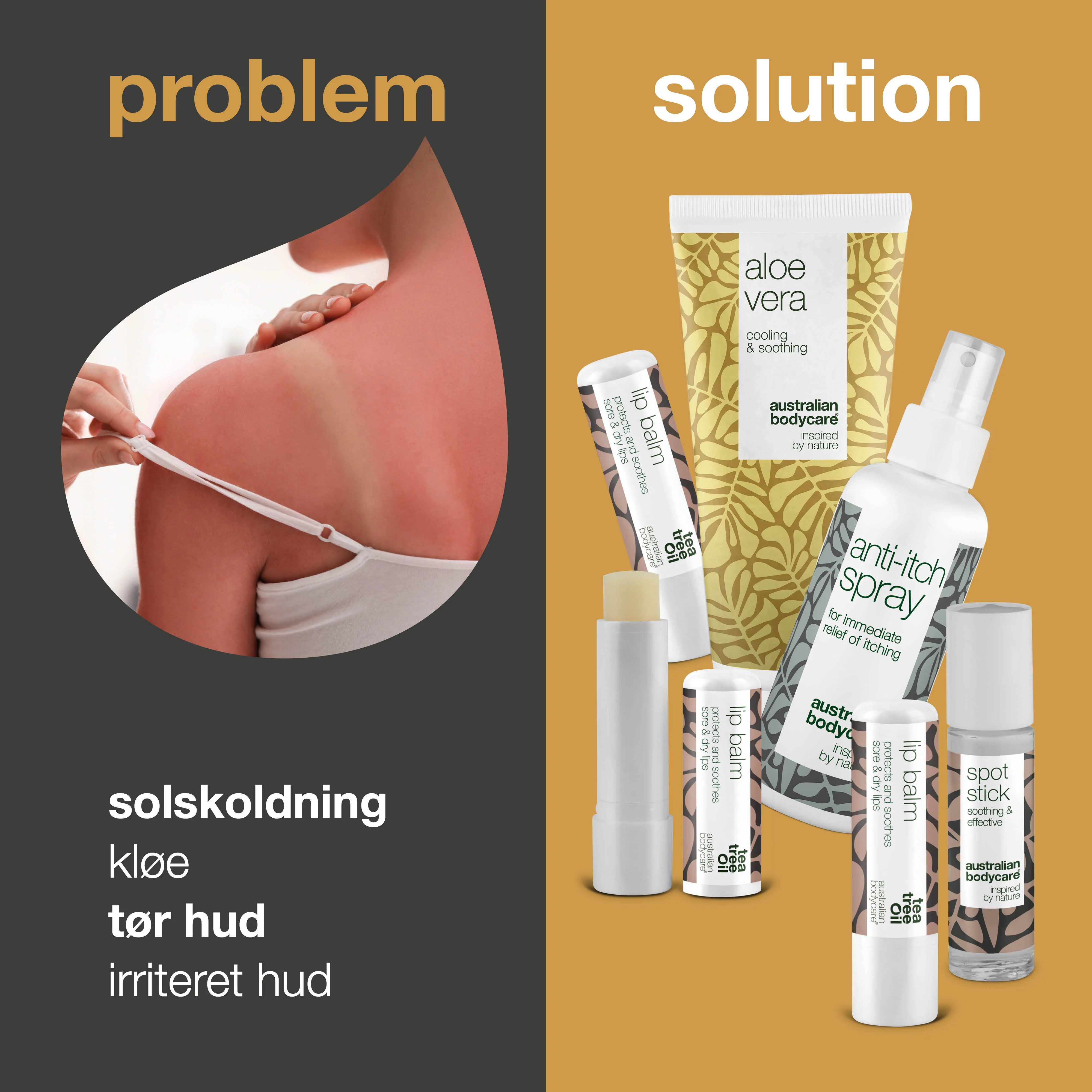 Sommerpakke — Produkter til pleje ved solskoldning eller insektbid - Image 2