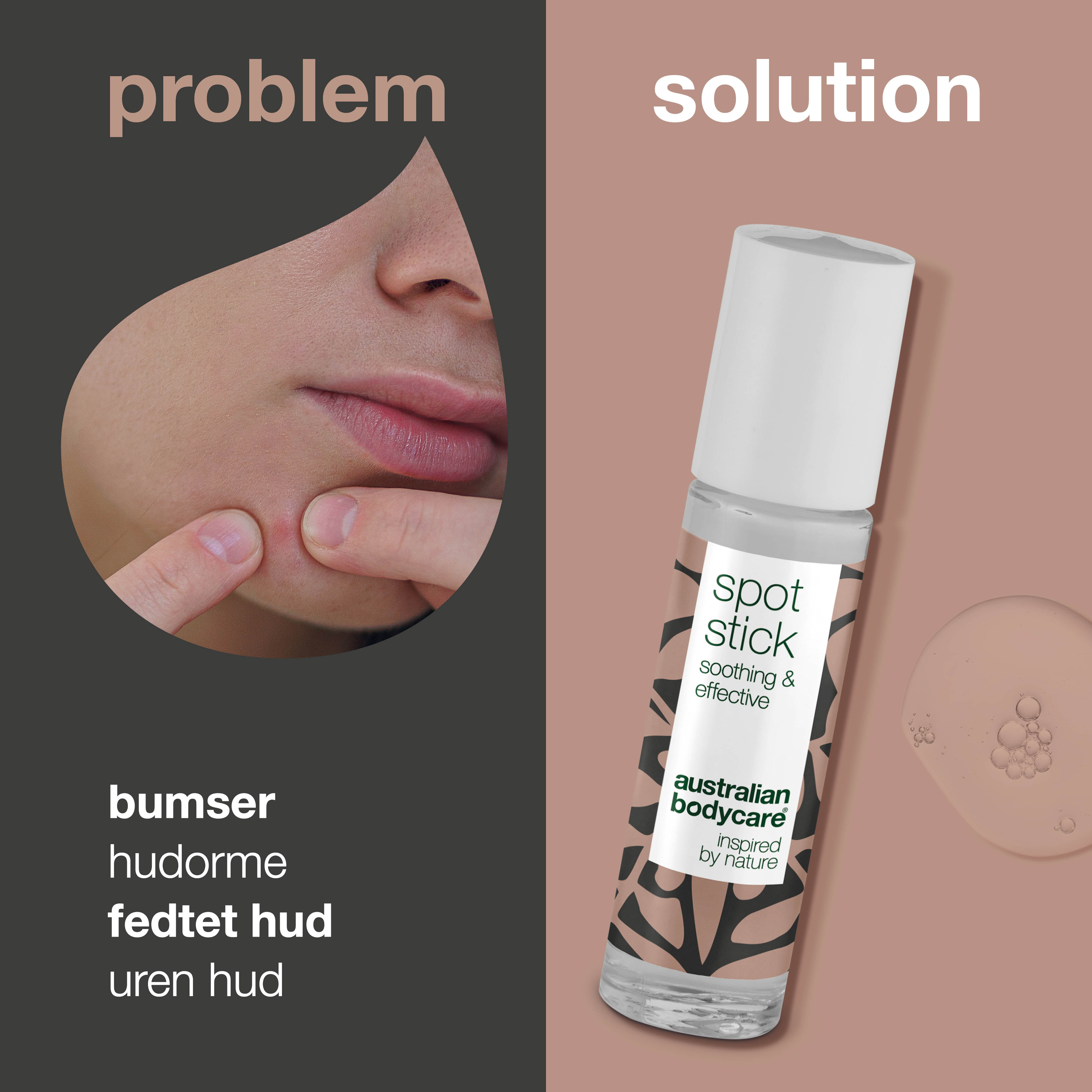 Spot Stick til bumser og uren hud — Effektiv mod bumser, uren hud og hudorme - Image 2
