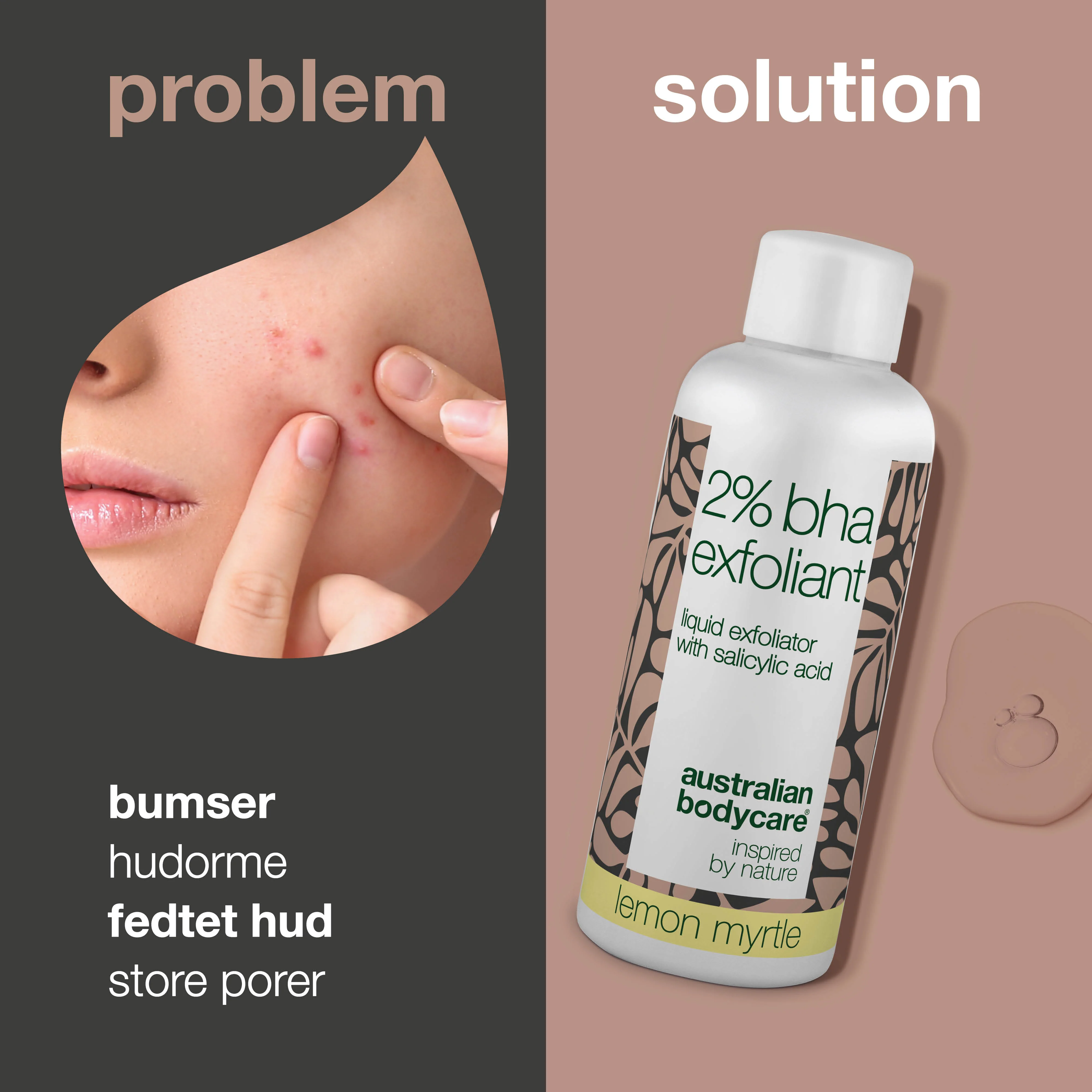 T-zone Peeling 2% BHA – Mod hudorme, bumser & fedtet hud — T-zone Peeling med 2% BHA salicylsyre reducerer bumser, hudorme og overskydende olie. Få en renere hud med færre urenheder. - Image 2